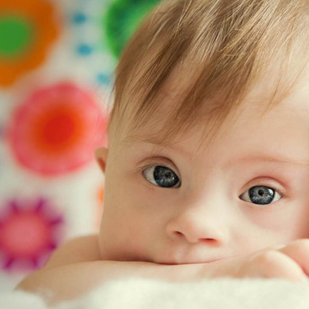BabyGym and a rare form of Down Syndrome known as Mosaicism